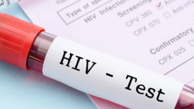 It is very important to get tested for HIV, as sexual health is as important as your overall well-being. When choosing to get tested in Dubai