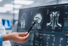 MRI: Redefining Diagnostic Imaging in Modern Healthcare