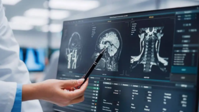 MRI: Redefining Diagnostic Imaging in Modern Healthcare