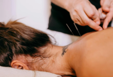 The Dos & Don'ts After Dry Needling