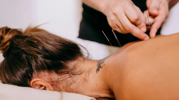 The Dos & Don'ts After Dry Needling